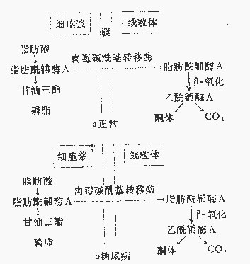 代谢酸中毒