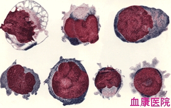 原始巨核细胞核幼稚巨核细胞模式图  医学教育网整理